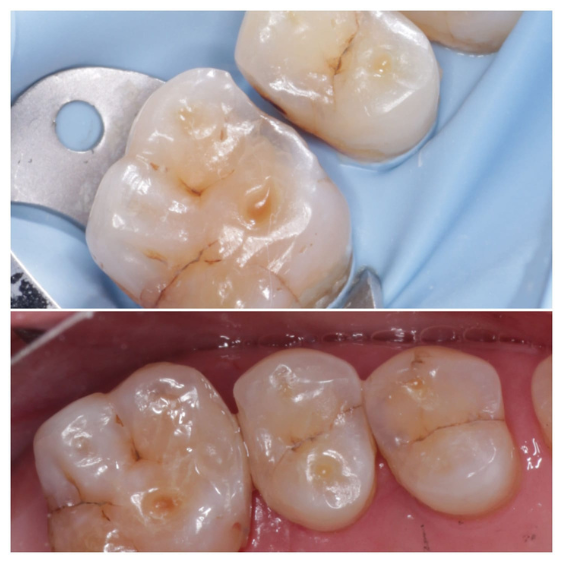 Cosmetic Dentist in Mahalaxmi Nagar Indore