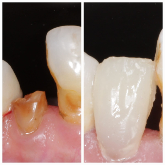 Cosmetic Dentist in Mahalaxmi Nagar Indore