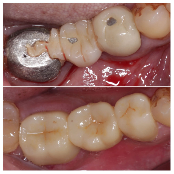 Cosmetic Dentist in Mahalaxmi Nagar Indore